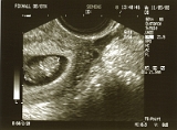 1st Ultrasound
